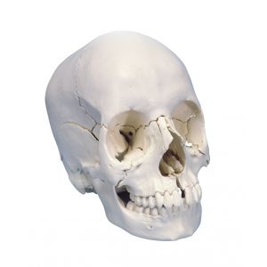 CRANIO SCOMPONIBILE 22 PARTI