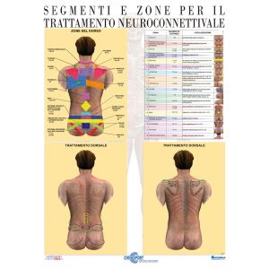 POSTER TRATTAMENTO NEUROCONNETTIVALE DORSALE