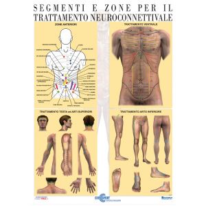 POSTER TRATTAMENTO NEUROCONNETTIVALE ANTERIORI E ARTI