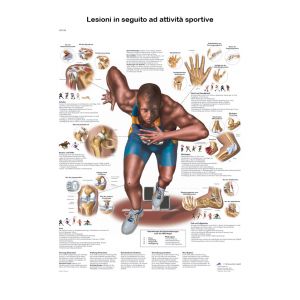 POSTER LESIONI DOPO ATTIVITA' SPORTIVA