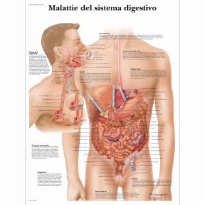 POSTER MALATTIE SISTEMA DIGESTIVO