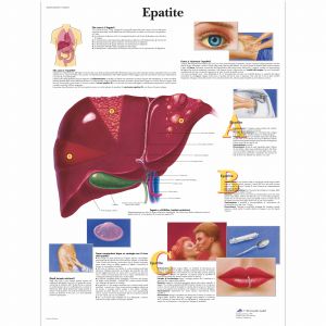 POSTER EPATITE