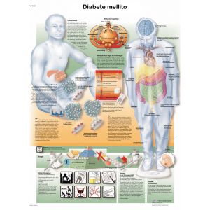 POSTER DIABETE MELLITUS