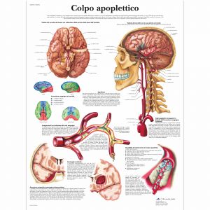 POSTER COLPO APOPLETTICO