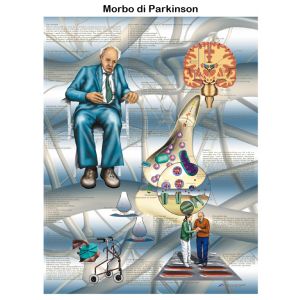 POSTER MORBO DI PARKINSON